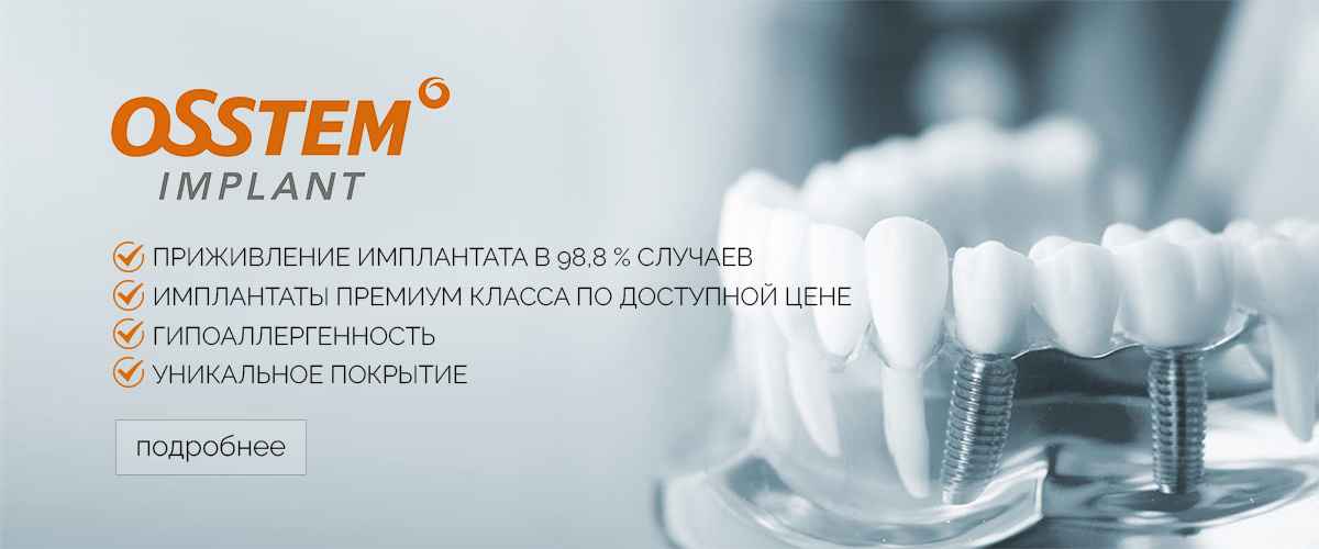 зубные импланты краснодар